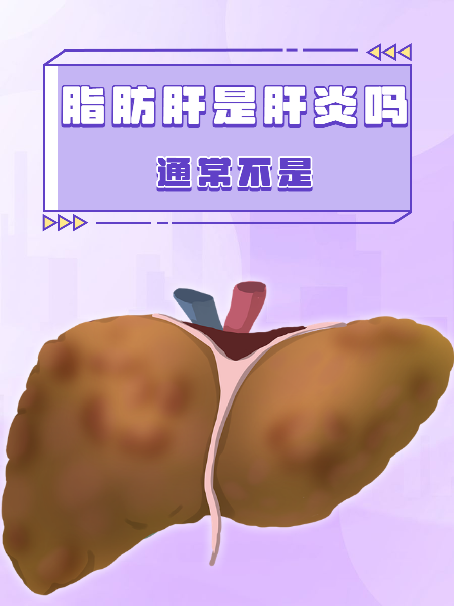微芯生物：西格列他钠治疗组肝脂肪含量下降明显
