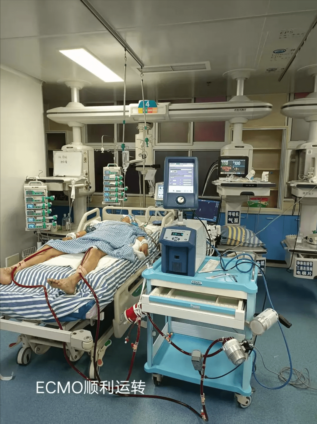 汉诺医疗科创板IPO已受理 核心产品Lifemotion®ECMO系统已覆盖全国超140家医院
