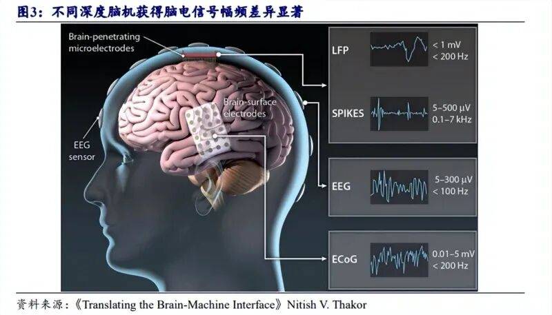 2025年中国脑机接口行业上游市场分析 脑电电极以无创电极为主【组图】