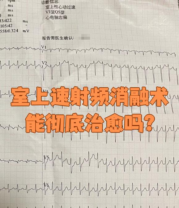 百利天恒最新公告：注射用BL-M11D1（CD33-ADC）用于治疗复发或难治性骨髓增生异常综合征获得药物临床试验批准